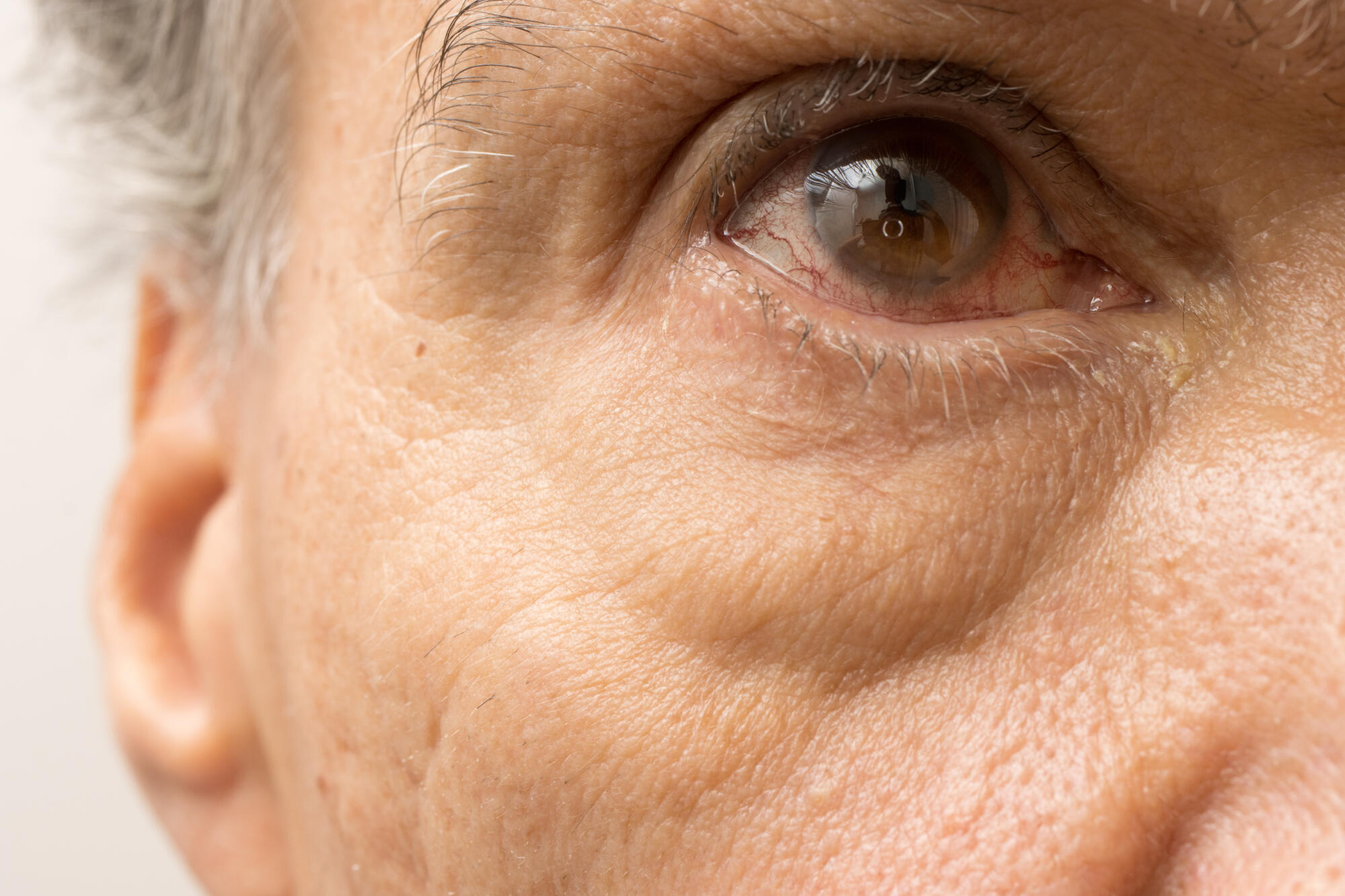 Diabetic Retinopathy Self-Care: Tips for Seniors